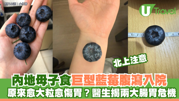 內地母子食巨型藍莓腹瀉入院 原來愈大粒愈傷胃？醫生揭兩大腸胃危機