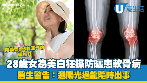 防曬｜28歲女為美白狂搽防曬 慘患「軟骨病」連咬嘢都無力！醫生警告：避陽光過龍隨時出事 附消委會6款滿分防曬推介