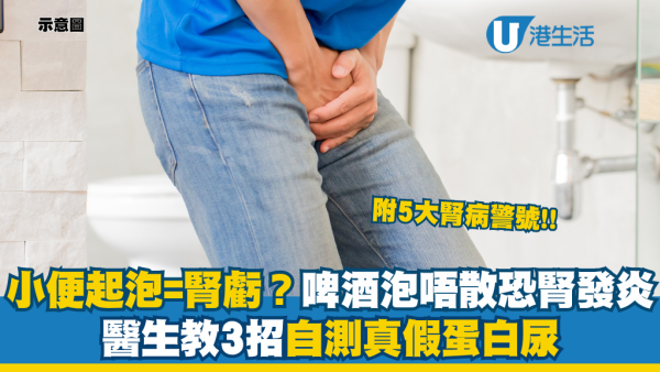 小便起泡=腎虧？醫生警告「啤酒泡」10分鐘唔散恐腎發炎：3招自測真假蛋白尿 附5大腎病警號
