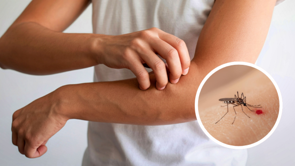 港人慘呻「變種蚊」攻陷香港！拆解5大特徵：今批蚊醒咗好多 附4大滅蚊神招