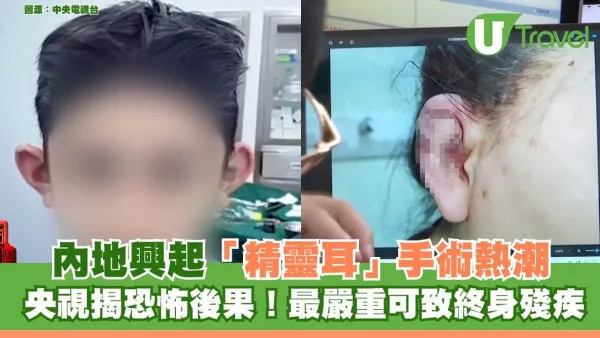 內地興起「精靈耳」整容手術熱潮 央視揭恐怖後果！最嚴重可致終身殘疾