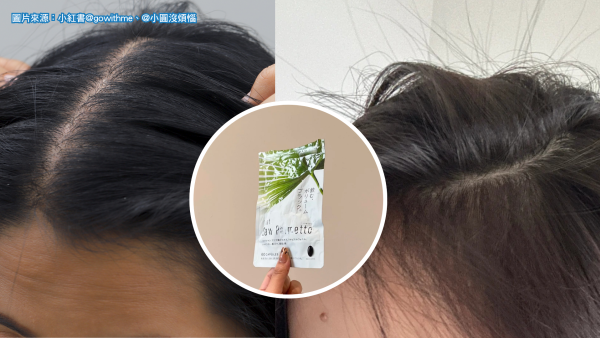 狂脫髮髮縫闊？DONKI隱藏$70生髮黑科技 實測1個月爆刺蝟胎毛
