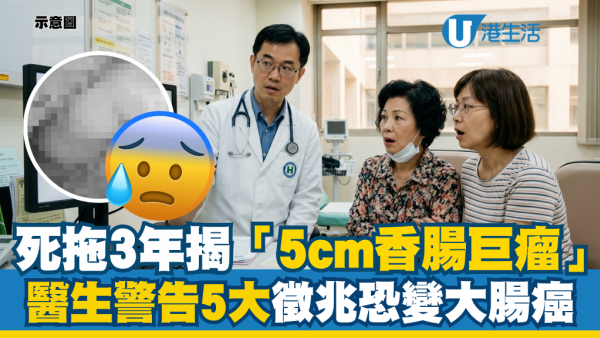中年婦拒照大腸鏡拖足3年！腹腔驚見「香腸狀巨型瘜肉」醫警告：5大徵兆恐已變大腸癌