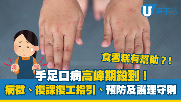 手足口病高峰期殺到！潛伏期幾耐？一文睇清病徵、傳染途徑及復課復工指引
