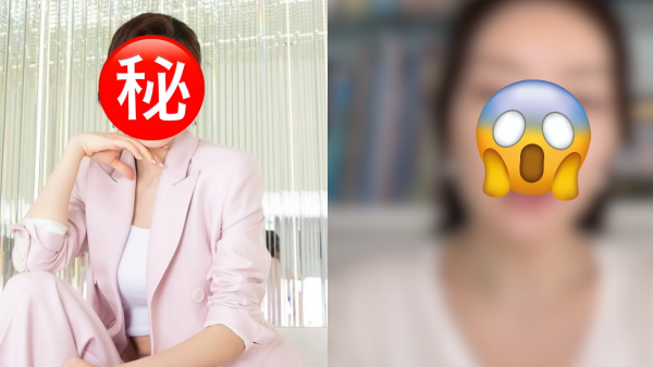 百億闊太直播親認「醫美肯定有做過」 屢被指變臉疑雲驚現蒜頭鼻進化