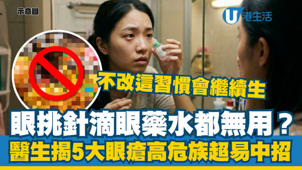 眼挑針滴眼藥水都無用？醫生揭5大眼瘡高危族：不改這習慣只會不斷生完又生
