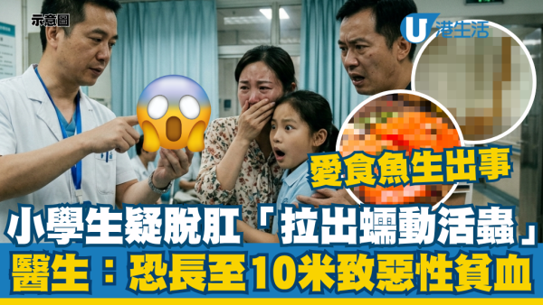 爱食鱼生出事！女童排便疑脱肛惊见“拉出2.6米活虫”医生警告：恐生长至10米致恶性贫血 教2招彻底灭虫