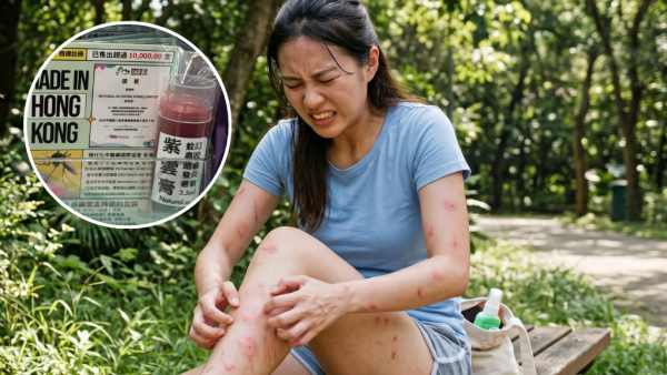 夏日神器｜唔止止痕抗發炎！本地出品$15「紫雲膏」 網民實測退腫極快 兼治濕疹尿布疹！成份天然 附購買地點