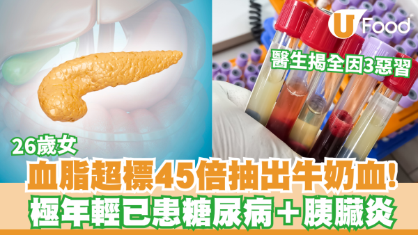 以為後生無事？26歲女血脂超標45倍患胰臟炎！醫生揭3大致命惡習