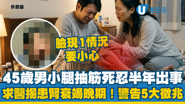 45歲男小腿抽筋死忍半年！求醫驚揭已是腎衰竭第4期！醫生警告5大徵兆不容忽視