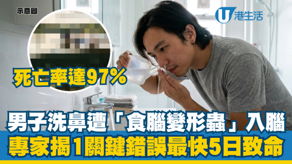 鼻敏感洗鼻出事！男子遭「食腦變形蟲」入侵大腦喪命 專家揭1個致命錯誤：活不過18天