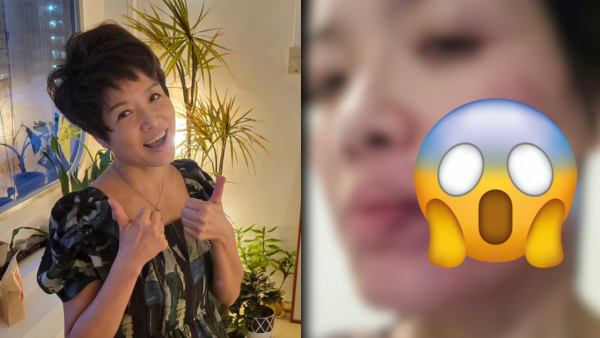 資深老戲骨驚爆被某女藝人掌摑至爆血管！恐怖傷勢曝光再點名澄清：關係非常良好