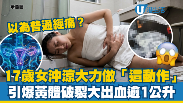 以為只是經痛？17歲少女沖涼順手做「這動作」引爆黃體破裂 休克大出血逾1000毫升