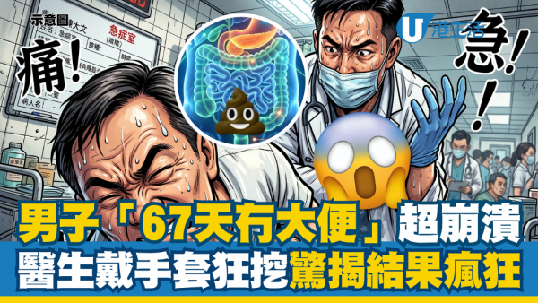 人夫崩潰「67天冇大便」緊急求醫！醫生無奈戴手套「強行狂挖」驚揭結果超瘋狂