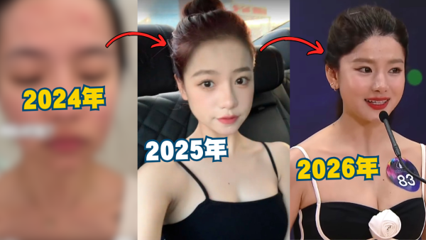 香港小姐2026｜蕃茄醬溫思婷舊照被挖疑似整容？黑歷史曝光改造兩大部位兼用假胸