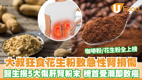 5大傷肝腎粉末食物︱大叔狂食花生粉致急性腎損傷！醫生揭5大傷肝腎粉末 咖啡粉/花生粉全上榜