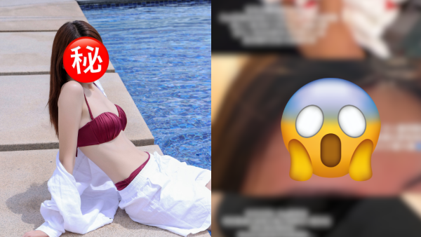 35歲女藝人驚傳突然受傷緊急送院！發生恐怖意外頭部爆缸：倒水式咁流出嚟