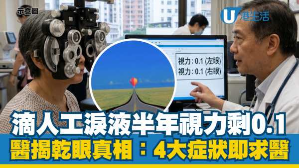 滴人工淚液半年視力暴跌剩0.1！醫生揭現代人乾眼真相：出現這4大症狀即求醫