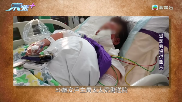 藍田邨廚房恐怖煤氣爆炸！女戶主四成皮膚燒傷「刮皮」淌血！命懸一線恐失工作能力