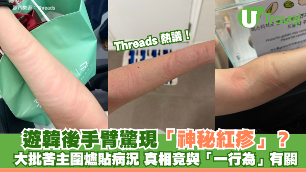 遊韓後手臂驚現「神秘紅疹」？Threads大批苦主圍爐貼病況 真相竟與「一行為」有關