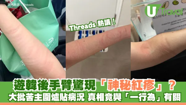 遊韓後手臂驚現「神秘紅疹」？Threads大批苦主圍爐貼病況 真相竟與「一行為」有關