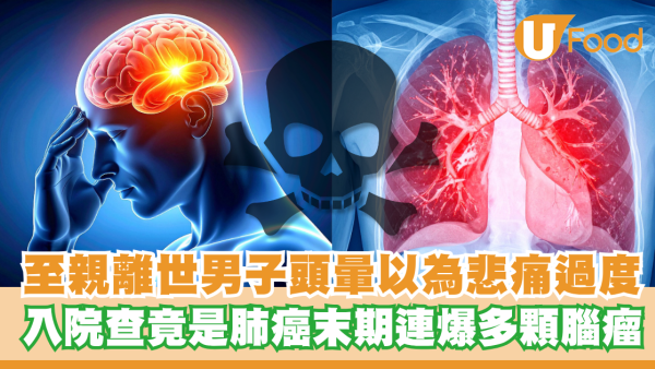 至親離世突發頭暈不止！男子以為悲痛過度  入院查竟是肺癌末期連爆多顆腦瘤