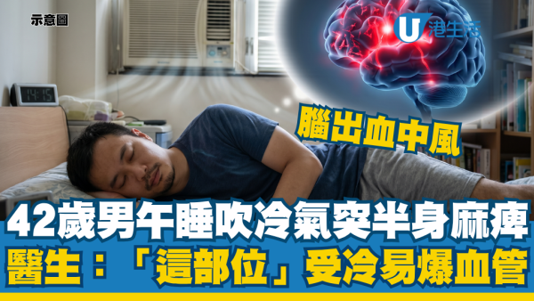 42歲男午睡吹冷氣突然半身麻痺！醫生警告狂吹「這部位」隨時誘發腦出血中風