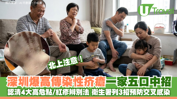 北上注意！深圳爆高傳染性疥瘡一家五口中招 認清4大高危點/紅疹辨別法 衛生署列3招預防交叉感染