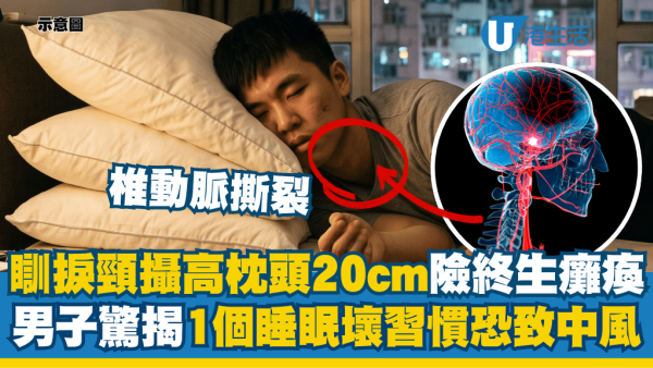 落枕擅自垫高枕头险终身瘫痪！男子1个睡眠坏习惯诱发“椎动脉撕裂”惊变中风