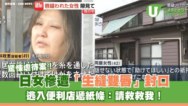 日本爆驚悚虐待案！日女慘遭「生縫雙唇」封口 逃入便利店遞紙條：請救救我！