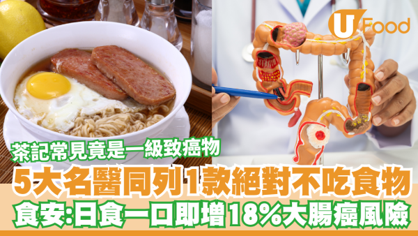 5大癌症名醫同列1款絕對不吃食物！食安中心：日食一口即增18%大腸癌風險