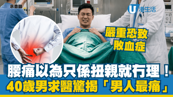 腰痛以為扭親就冇理！40歲男緊急求醫驚揭「男人最痛」 醫揭嚴重恐致敗血症