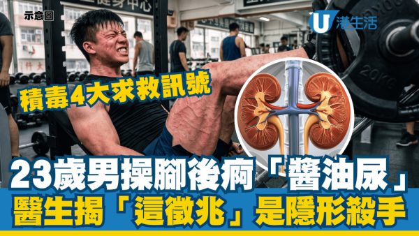 23歲男操腳後雙腿發硬痾「醬油尿」 醫生驚揭積毒4大求救訊號：「這個」是隱形殺手