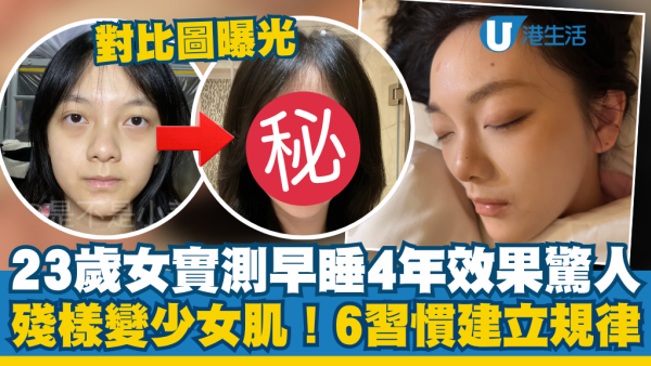 23歲女實測「早睡4年」效果驚人！對比圖曝光殘樣變少女肌 黑眼圈淚溝全消失