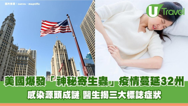 美國爆發「神秘寄生蟲」疫情蔓延32州！感染源頭成謎 醫生揭三大標誌症狀