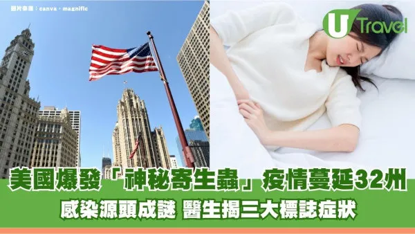 美國爆發「神秘寄生蟲」疫情蔓延32州！感染源頭成謎 醫生揭三大標誌症狀