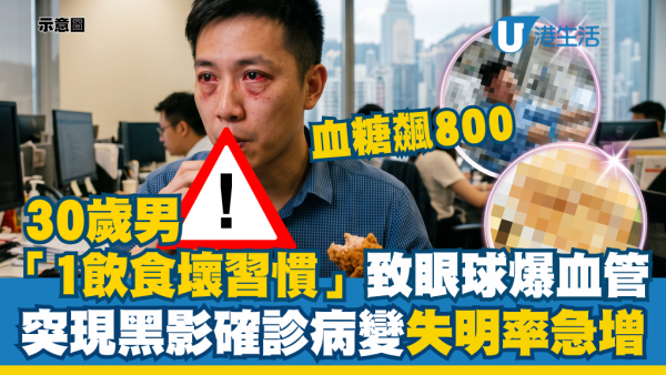 30歲男「1飲食壞習慣」致眼球爆血管！醫揭突現黑影確診病變 血糖狂飆失明率急增