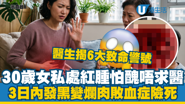 30歲女私處紅腫怕尷尬唔睇醫生！死忍3日極速惡化代價極高：醫揭6大致命警號