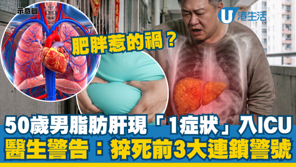 50歲工程師脂肪肝出現「1症狀」即送ICU！醫生警告：猝死前3大連鎖警號