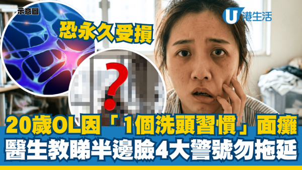 20歲OL因「1個洗頭壞習慣」致面癱漏口！醫生教睇半邊臉4大警號：拖延恐永久受損