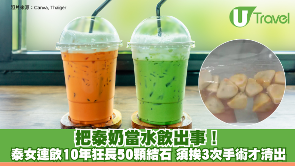 把泰奶當水飲出事！女子連飲10年狂長50顆結石 須接受3次手術才清出