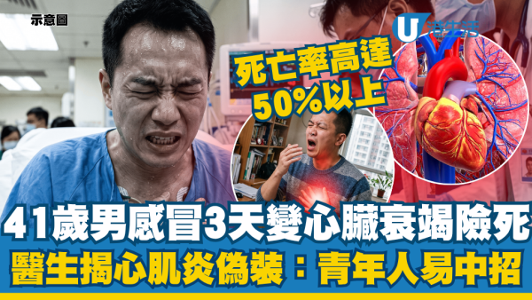 41歲男感冒3天心臟衰竭險死！醫生揭辨別心肌炎4大徵兆：死亡率高達50%