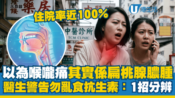 25歲女喉嚨痛死忍4天險窒息！醫生警告別亂食抗生素：1招分辨普通發炎與扁桃腺膿腫