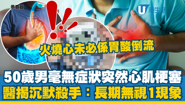 烧心未必是胃酸倒流！50岁男无症状心肌梗塞 医生揭隐形沉默杀手：长期无视“1现象”