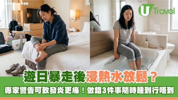 遊日暴走後浸熱水放鬆？專家警告可致發炎更痛！做錯3件事隨時腫到行唔到