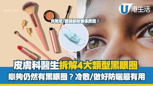 黑眼圈消除｜瞓夠仍然有黑眼圈？皮膚科醫生拆解4大類型 冷敷/做好防曬最有用！