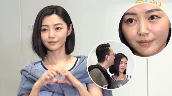衛詩雅親身還原嘴唇割傷恐怖瞬間！伸脷舔驚覺裂開失去知覺：唔敢睇個傷口
