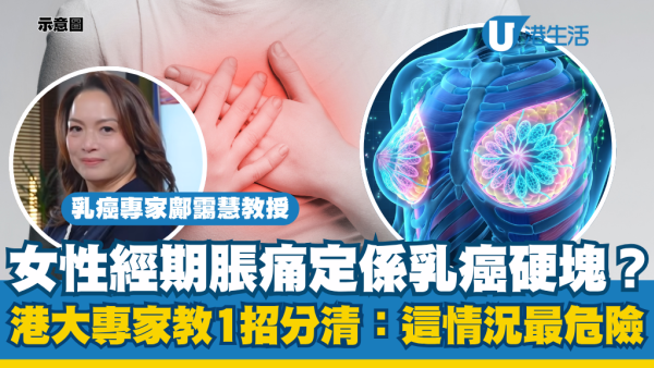 重症解密｜胸部硬塊未必係乳癌？港大專家教分清經期脹痛：1情況不消退最危險