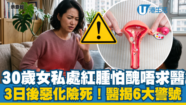 30歲女私處紅腫怕尷尬唔睇醫生！死忍3日極速惡化代價極高：醫揭6大致命警號