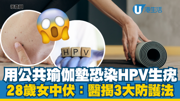 28歲女共用瑜伽墊竟感染HPV背部生滿疣！醫生傳授3大防護清單：做漏這一步等同直接接觸